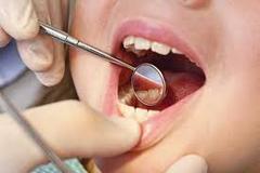 ارائه خدمات معاينه رايگان به مناسبت روز دندانپزشك 